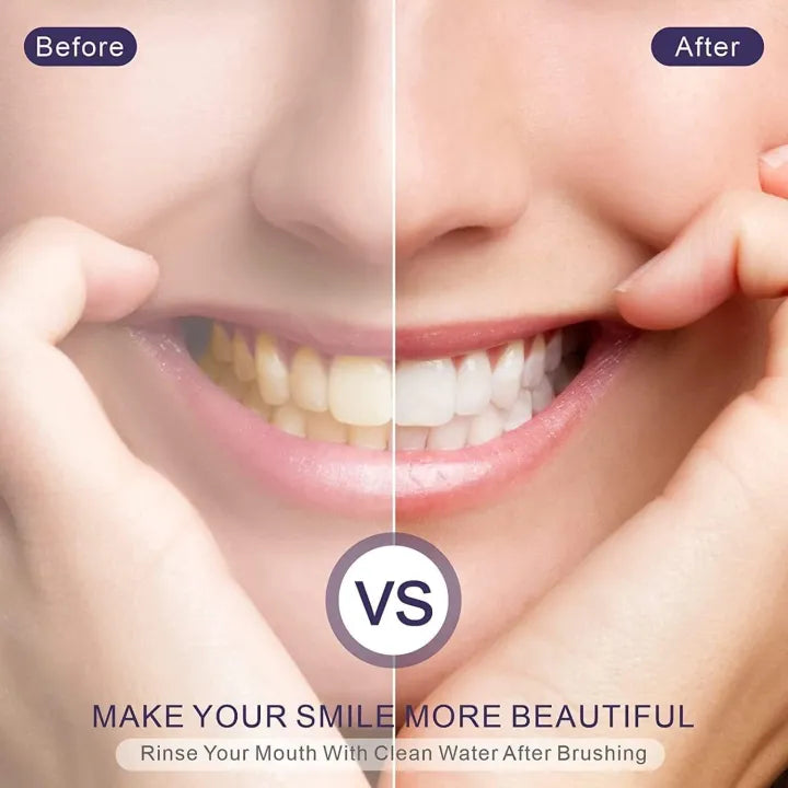 Hismile Teeth Whitening